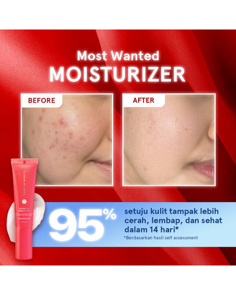 MOISTURIZER - SKIN BARRIER WATER CREAM (CERAMIDE) - IMPROVED FORMULA